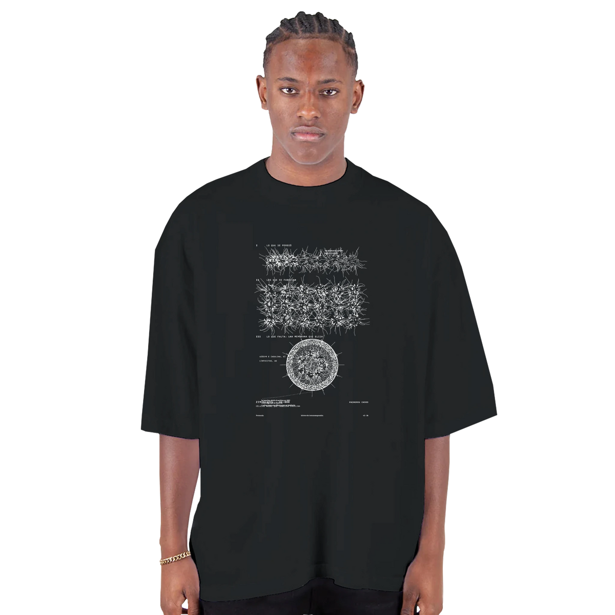 ISLOTES ENCAPSULADOS · Islotes sin Inmunosupresión — Camiseta Oversized de Hombro Caído